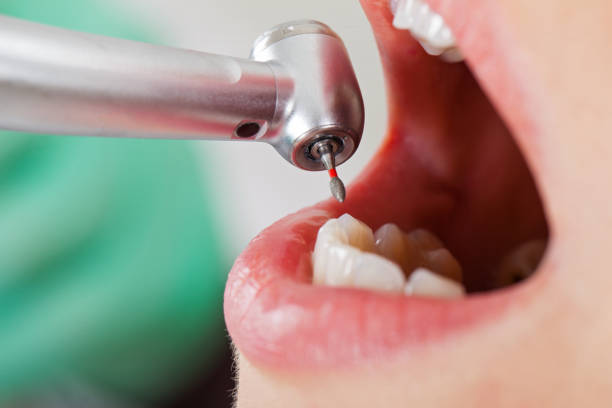 Best Emergency Gum Treatment in Ovilla, TX